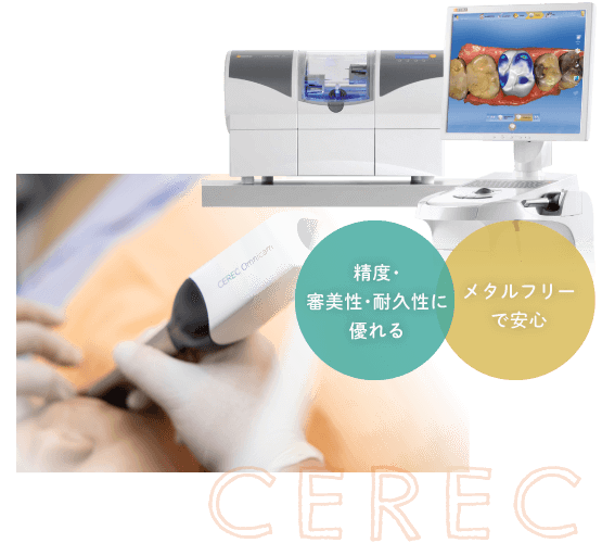 精度・審美性・耐久性に優れる／メタルフリーで安心