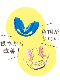 プレオルソ矯正・ネオキャップビムラー矯正＜根本から改善！負担が少ない＞